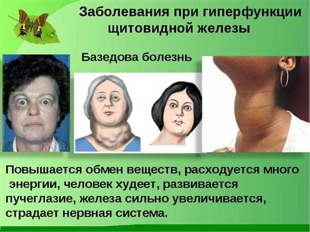 Неврологические аспекты болезней щитовидной железы