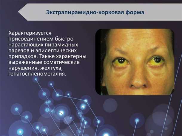 Неврологические аспекты болезни Вильсона