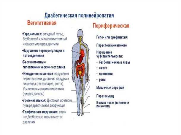 Сочетание диабета и поражения нервной системы: механизмы и причины развития