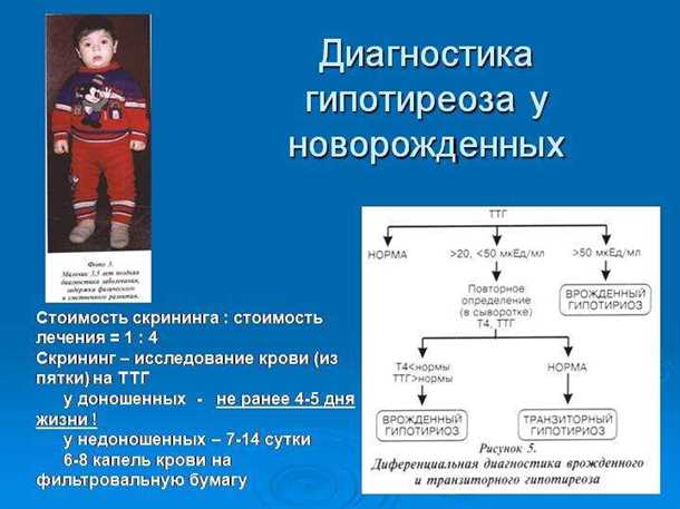Неврологические аспекты гипотиреоза у новорожденных
