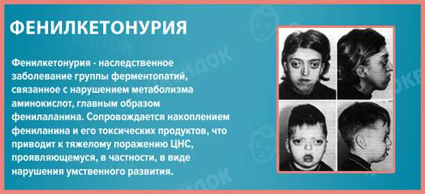 Влияние неврологических аспектов на качество жизни пациентов с фенилкетонурией