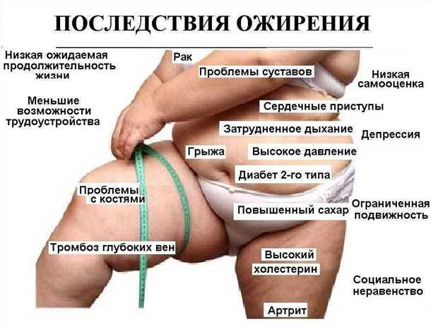 Типы неврологических заболеваний, связанных с ожирением