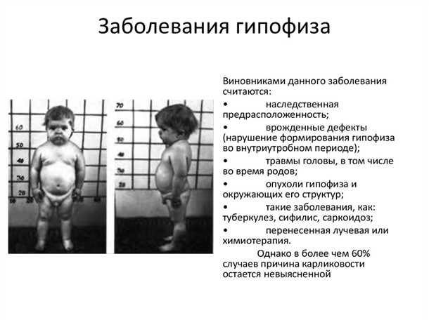Неврологические аспекты при детских заболеваниях гипофиза.