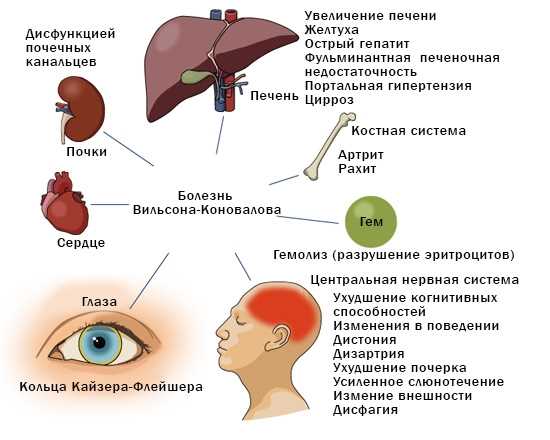 Клинические признаки нервных осложнений при заболеваниях печени у детей
