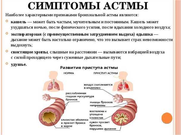 Неврологические аспекты при детском бронхиальном астме.