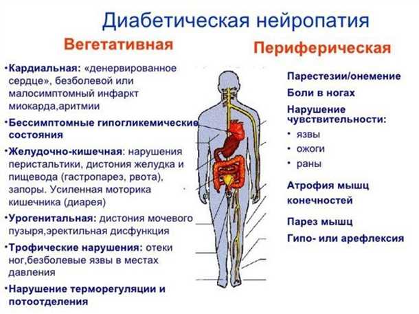 Влияние гипергликемии на психическое состояние при сахарном диабете