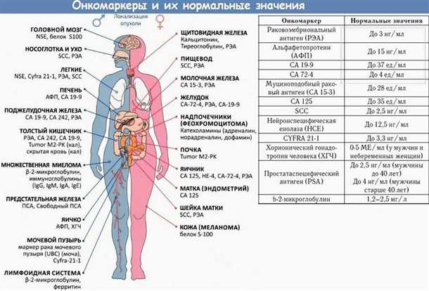 Эффективные методы диагностики саркомы нервной системы