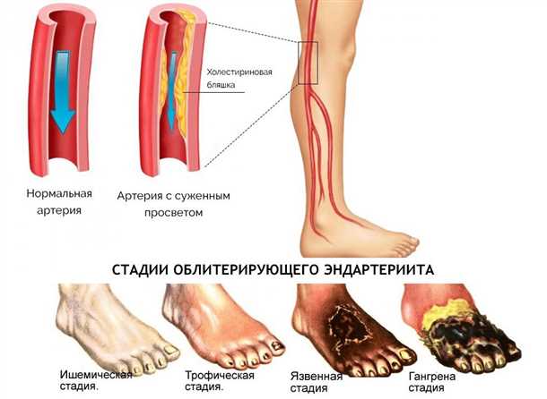 Общие проблемы системы кровообращения конечностей: вызовы, риски и влияние на организм