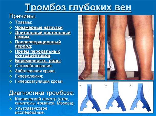 3. Хирургическое лечение
