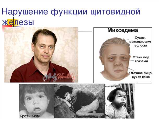 Влияние гормонов щитовидной железы на нервную систему