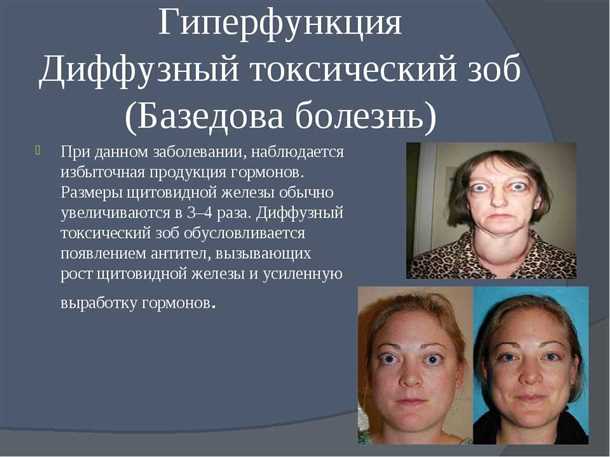 Влияние щитовидной железы на функции нервной системы