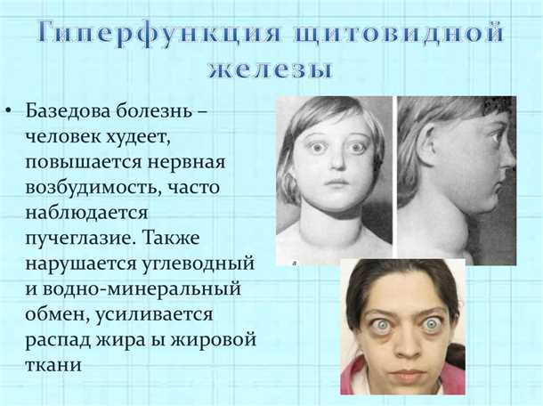 Влияние щитовидной железы на психическое состояние: актуальность исследования