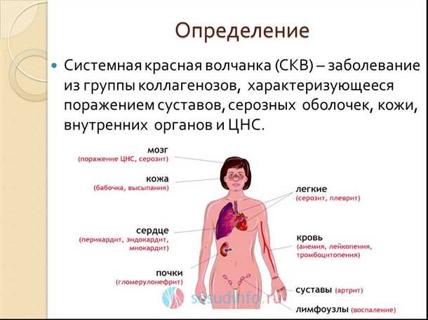 Механизмы генетической предрасположенности