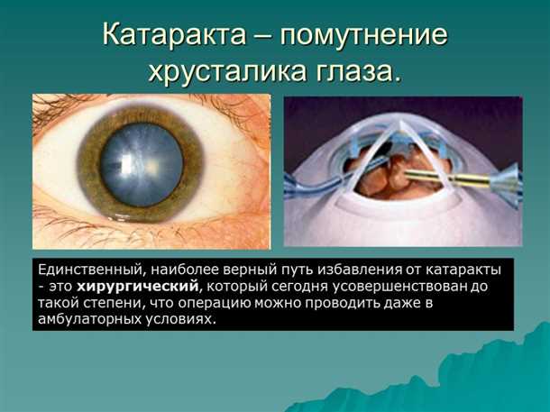 Значение неврологической диагностики в обнаружении глаукомы