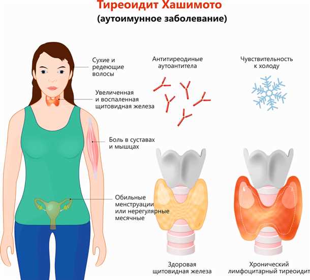 Влияние аномалий щитовидной функции на нервную систему