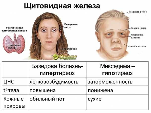 3. Риски, связанные с повышенной активностью щитовидной железы