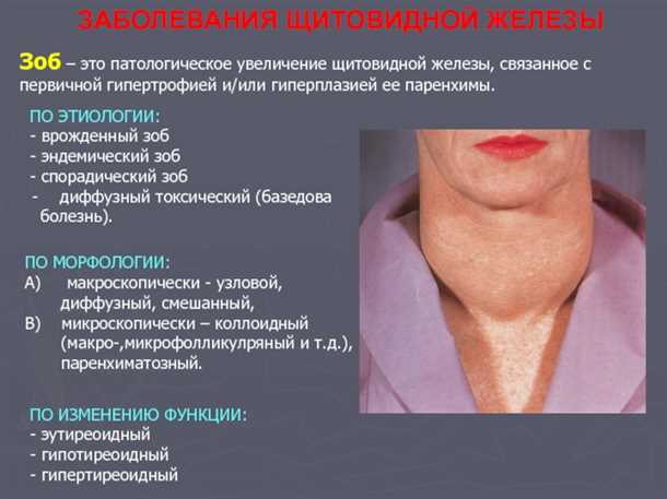 1. Краткое описание повышенной активности щитовидной железы