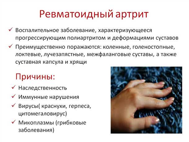 Симптомы неврологических проявлений при ревматоидном артрите