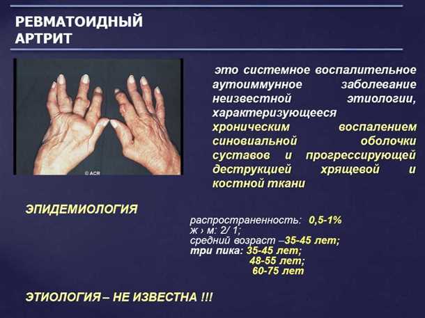 1. Влияние воспаления на нервную систему