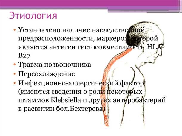 Лечение неврологических симптомов при болезни Бехтерева