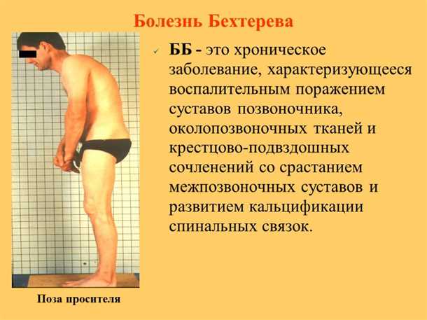 Правильное сидение и организация рабочего места