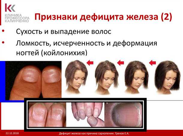 Важность эффективной концентрации при достаточном уровне железа в организме