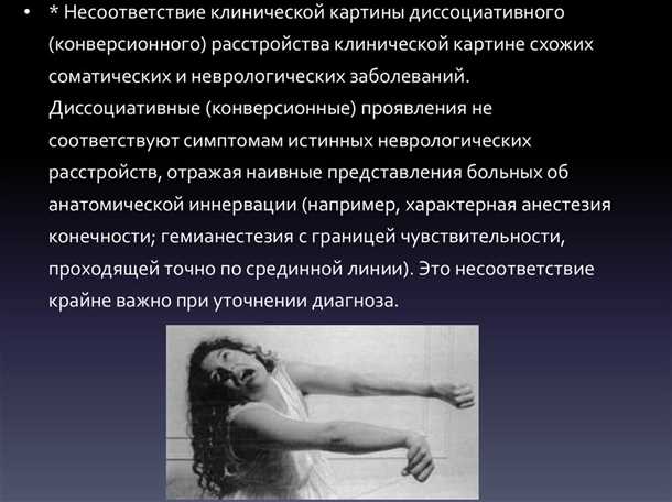 Функциональные расстройства движения и их причины