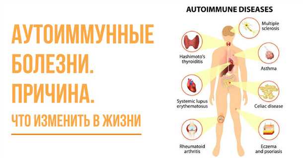 Неврологические проявления при аутоиммунных заболеваниях кожи.
