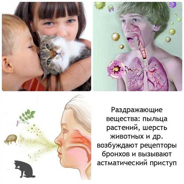 Влияние аллергии на шерсть на поведение ребенка