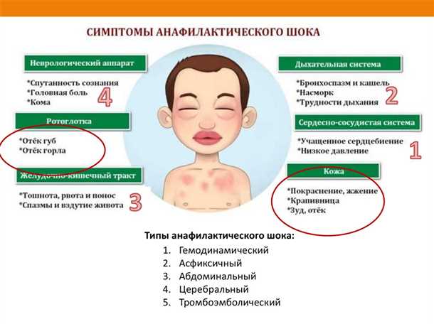 Различные методы для диагностики аллергических реакций на пищевые добавки