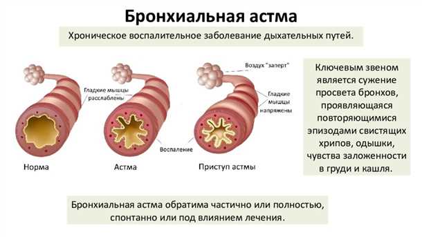 Неврологические проявления при детской бронхиальной астме.