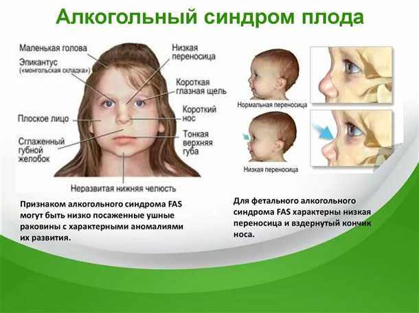 Неврологические проявления при детском алкоголизме матери.