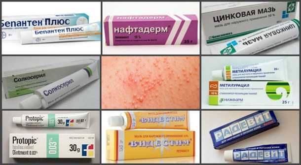 Возможные проявления неврологических симптомов
