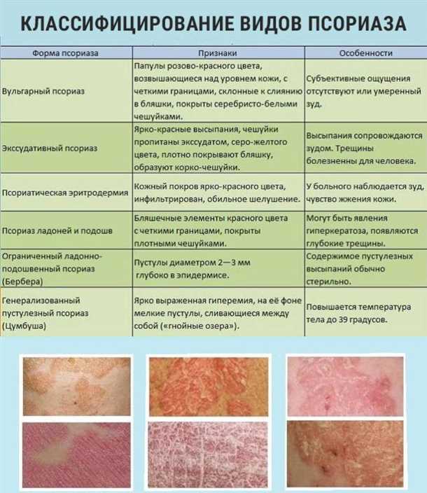 Методы лечения неврологических проявлений при детском аллергическом дерматите
