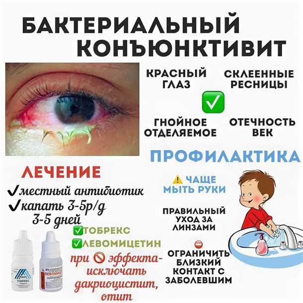 Регулярные физические упражнения