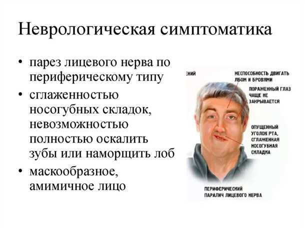 Неврологические проявления при системных гематологических заболеваниях.