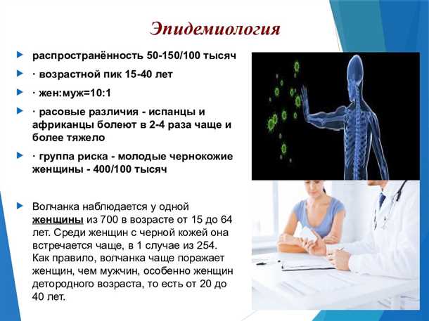 2. Ревматические заболевания