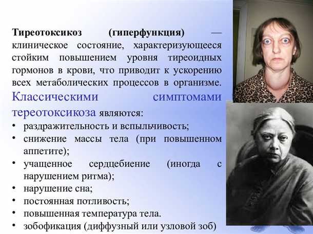 Неврологические проявления тиреотоксикоза