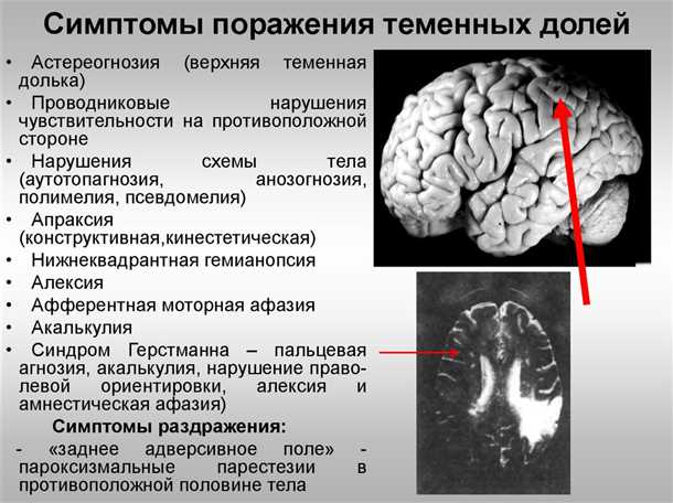 Нейроимиджинг