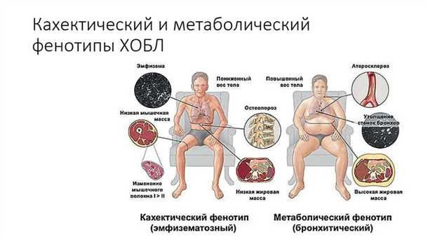 Неврологические проявления заболеваний органов дыхания (например, хроническая обструктивная болезнь легких)