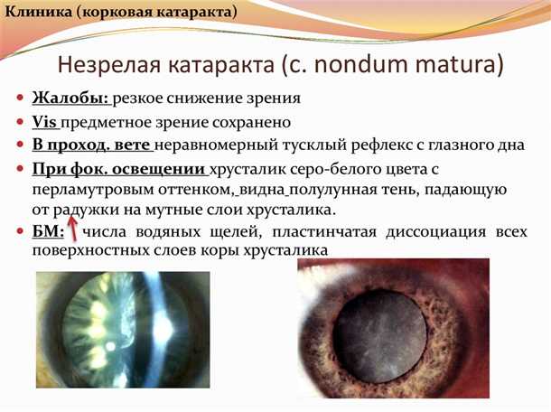Лекарственное лечение и физиотерапия