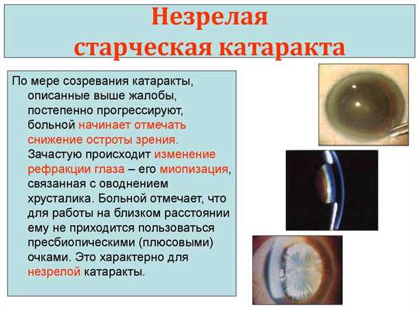 1. Потеря четкости зрения