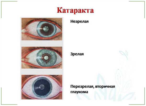 2. Генетическая предрасположенность
