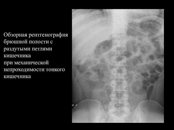 Продолжительность исследования