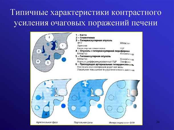Медикаментозное лечение при заболеваниях печени