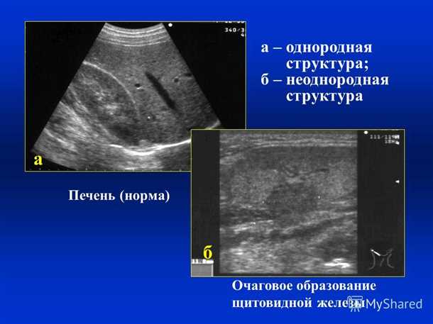 Основные типы опухолей печени