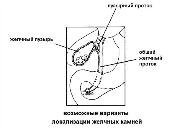 Что происходит после очищения желчного пузыря: реабилитация и последствия