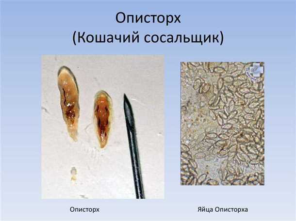 2. Боли в животе: