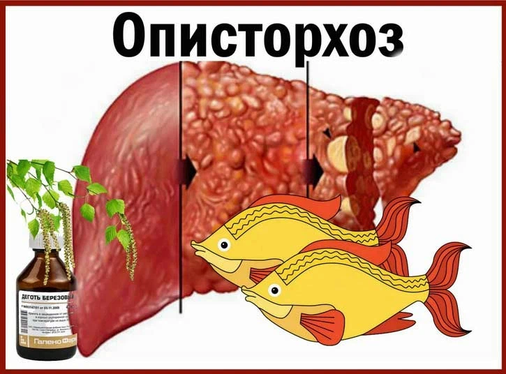 3. Желтуха: