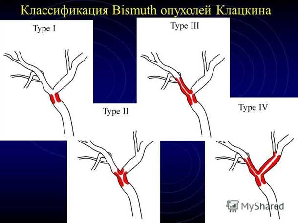 Головокружения и нарушение равновесия